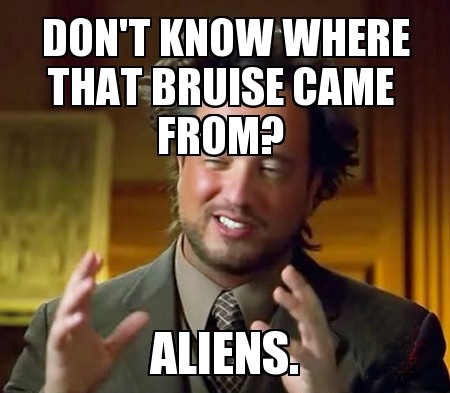 Don't know where those bruises came from? Aliens.