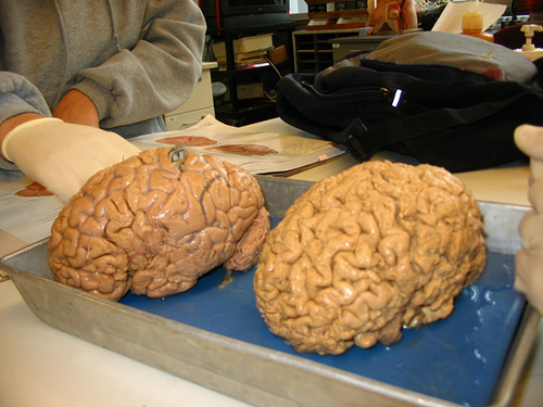 Brains will be prepped and ready for those who need them.